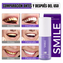 Blanqueador Dental SMILE <span style="color: #000000;"><strong><span style="color: #ff2a00;">¡COMPRA 1 Y LLÉVATE 2!</span></strong></span>