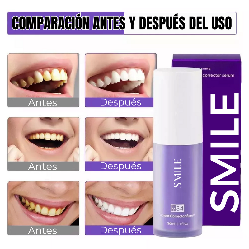 Blanqueador Dental SMILE <span style="color: #000000;"><strong><span style="color: #ff2a00;">¡COMPRA 1 Y LLÉVATE 2!</span></strong></span>